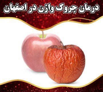 درمان چروک واژن در اصفهان