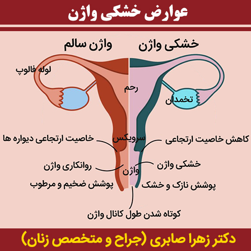 عوارض-خشکی-واژن