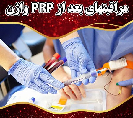 مراقبتهای-بعد-از-PRP-واژن