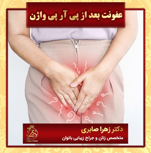 عفونت-بعد-از-پی-آر-پی-واژن
