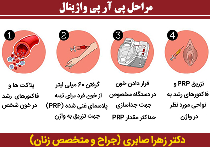 مراحل-پی-آر-پی-واژینال