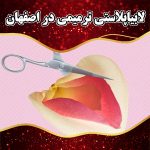 لابیاپلاستی-ترمیمی-در-اصفهان