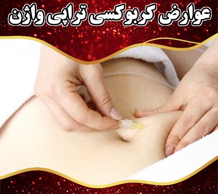 عوارض-کربوکسی-تراپی-واژن