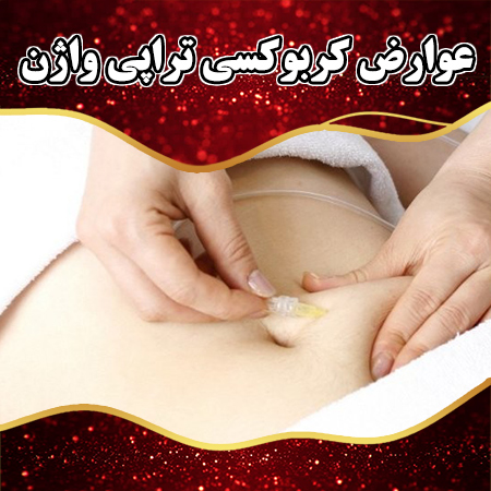 عوارض-کربوکسی-تراپی-واژن