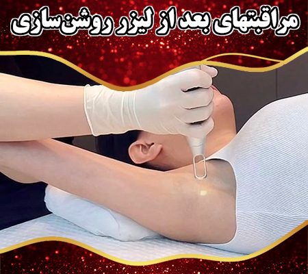مراقبتهای-بعد-از-لیزر-روشن‌سازی