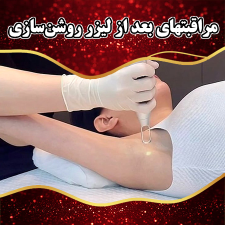 مراقبتهای-بعد-از-لیزر-روشن‌سازی
